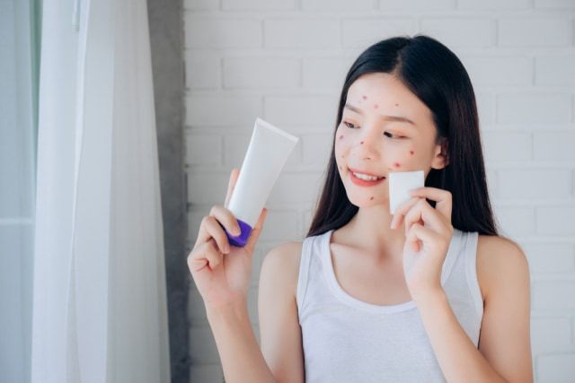 8 Kandungan Skincare yang Harus Dihindari untuk Kulit Berjerawat