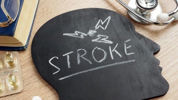 Kasus Stroke Usia 20-50 Tahun Meroket 2 Kali Lipat, Pakar Ungkap Pemicu Utamanya